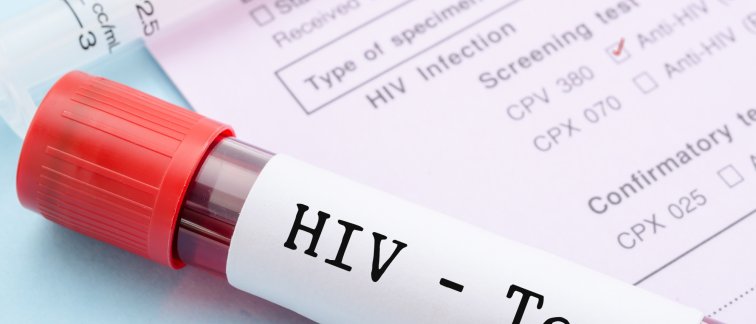 Discovery Of New More Infectious HIV Variant